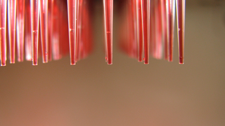 French Lab Forced to Close After Losing Thousands of SARS Samples